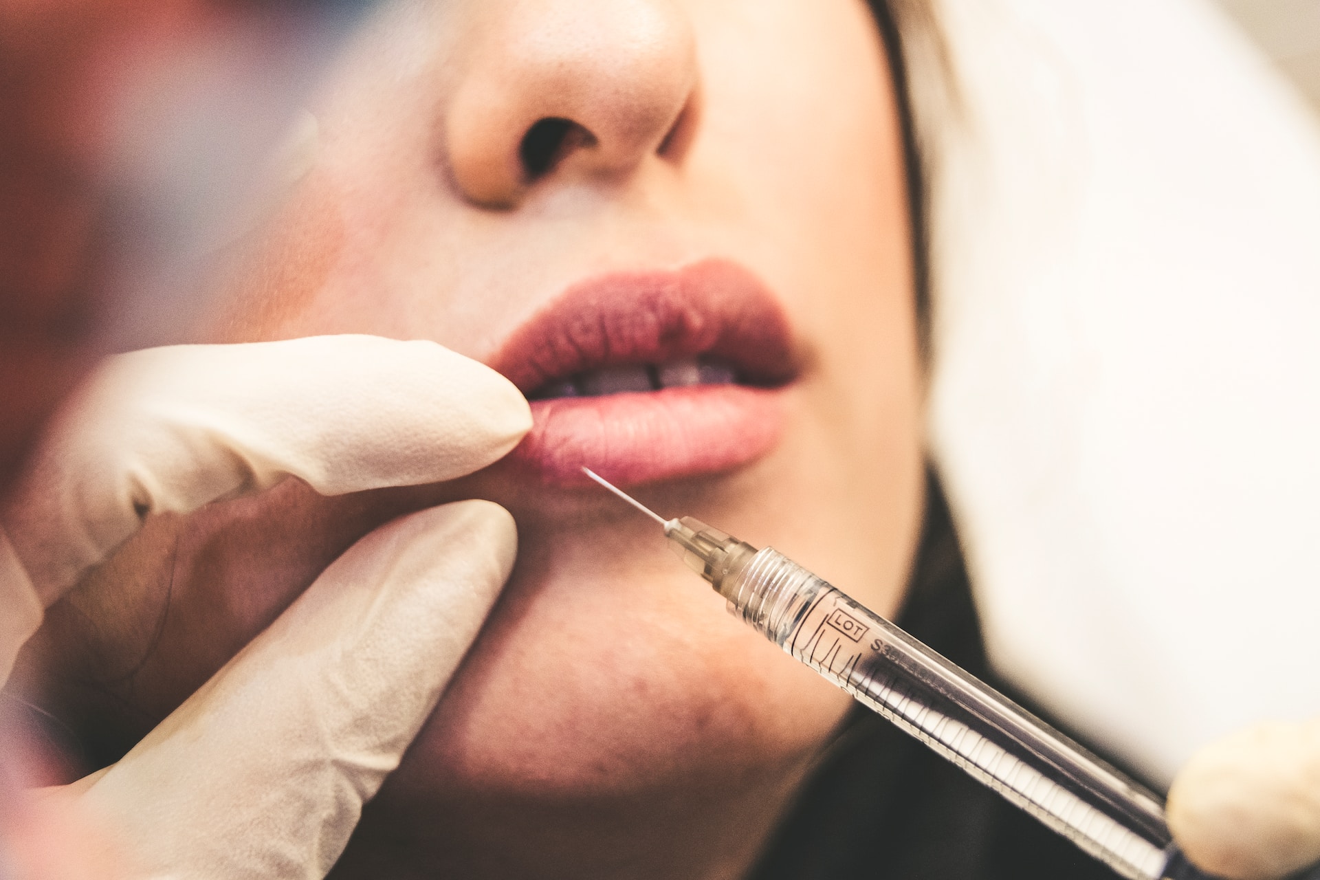 Botox and Lip Fillers